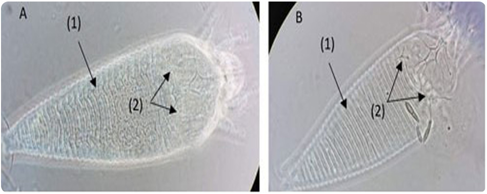 شکل 2. تفاوت های مورفولوژیکی بین کنه زنگ مرکبات، Phyllocoptruta oleivora (Ashmead) (A)، و کنه صورتی مرکبات زنگ، Aculops pelekassi (Keifer) (B)، مشاهده شده با میکروسکوپ کنتراست فاز.