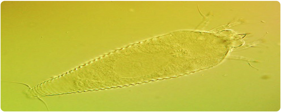 شکل 3. نمای پشتی کنه زنگ مرکبات Phyllocoptruta oleivora (Ashmead).
