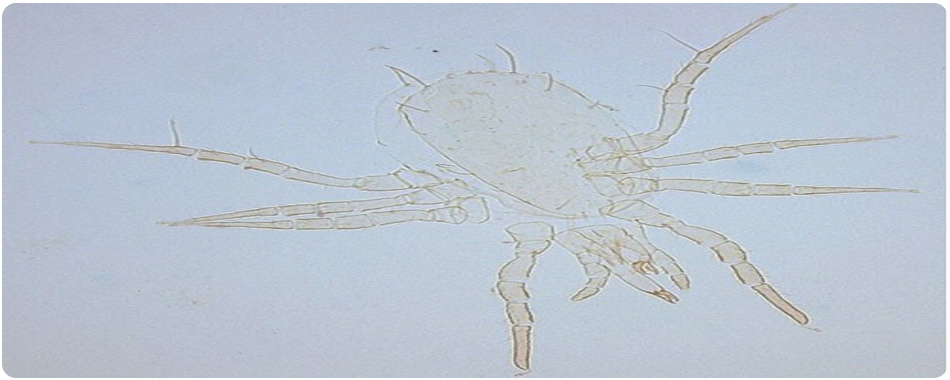 شکل 6 . ماده بالغ Typhlodromalus peregrinus (موما)، کنه های شکارچی که از Phyllocoptruta oleivora (Ashmead) تغذیه می کند ، با میکروسکوپ کنتراست فاز مشاهده شد . 